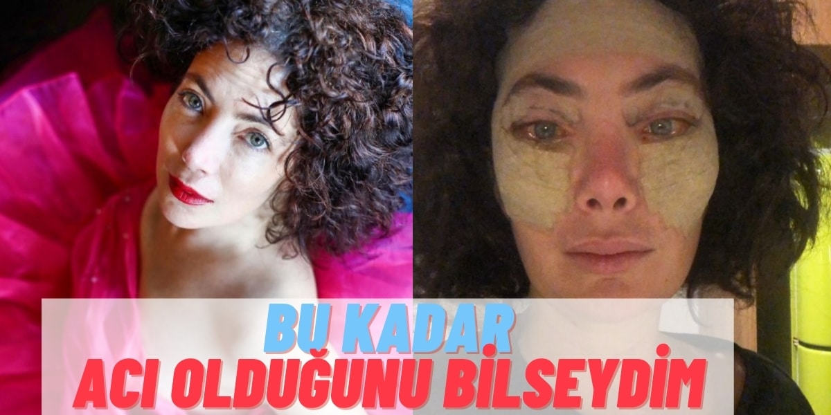 Akasya Asıltürkmen ‘Bella Eyes’ Operasyonu Yaptırdı: “Bu Kadar Acı Olduğunu Bilseydim…”