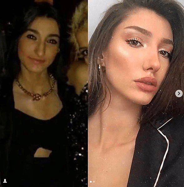 2018 Miss Turkey Güzeli Şevval Şahin'in Değişimi Görünce ...