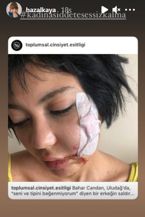 Hazal Kaya story