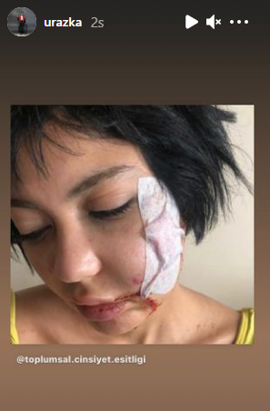 Uraz Kaygılaroğlu story