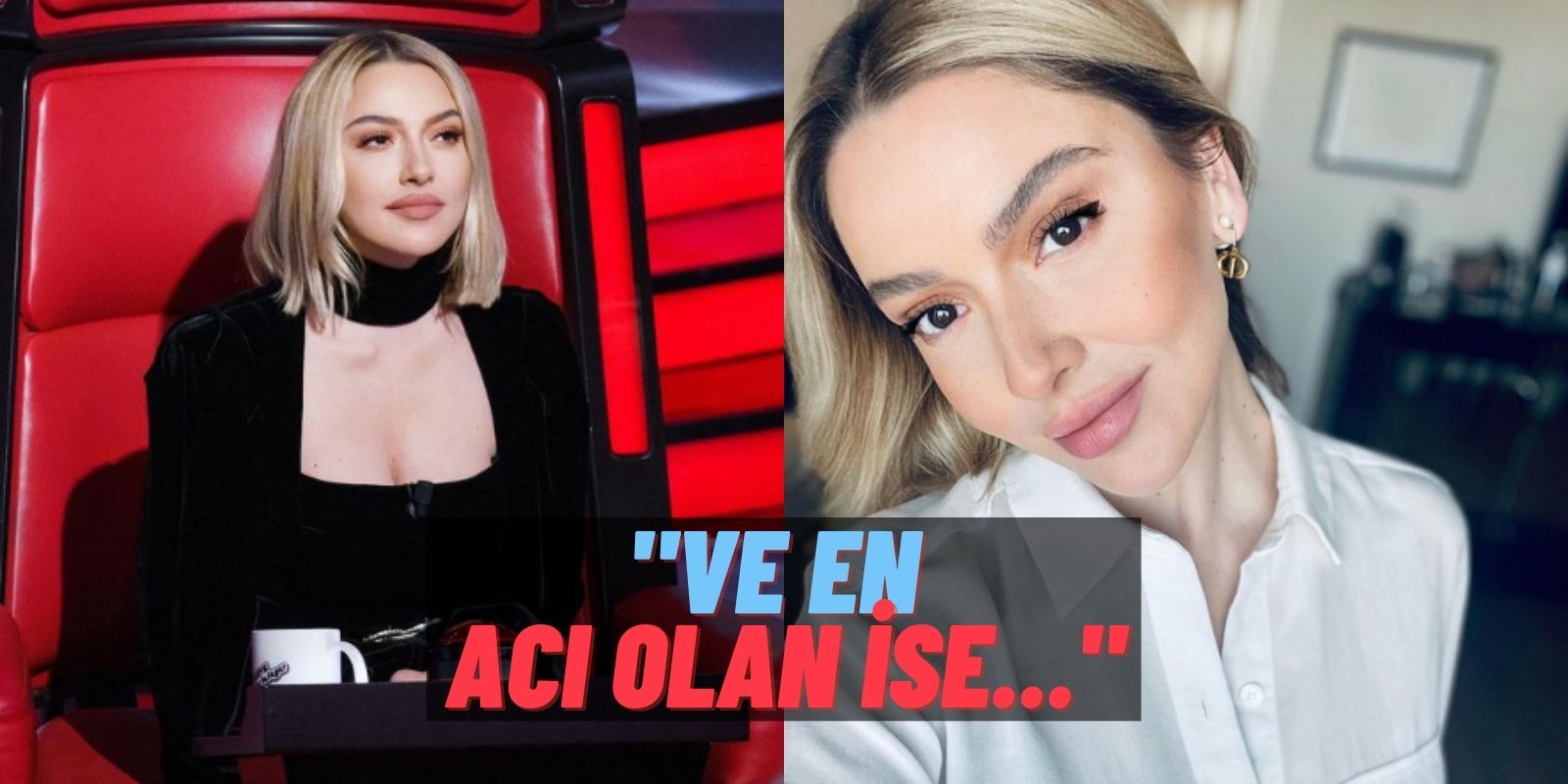 Hadise Açtı Ağzını Yumdu Gözünü! Linçleyenlere Kin Kustu: “Obez Dediler, Roberto Carlos Bacaklı Dediler!”