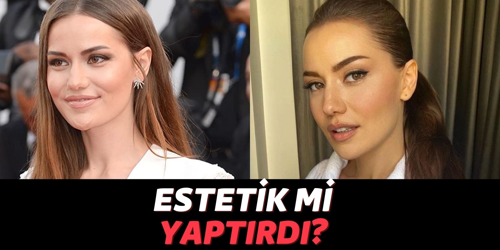 Yok Artık! Fahriye Evcen Makyajsız Halini Paylaştı Görenler İnanamadı: Estetik mi Yaptırdı?