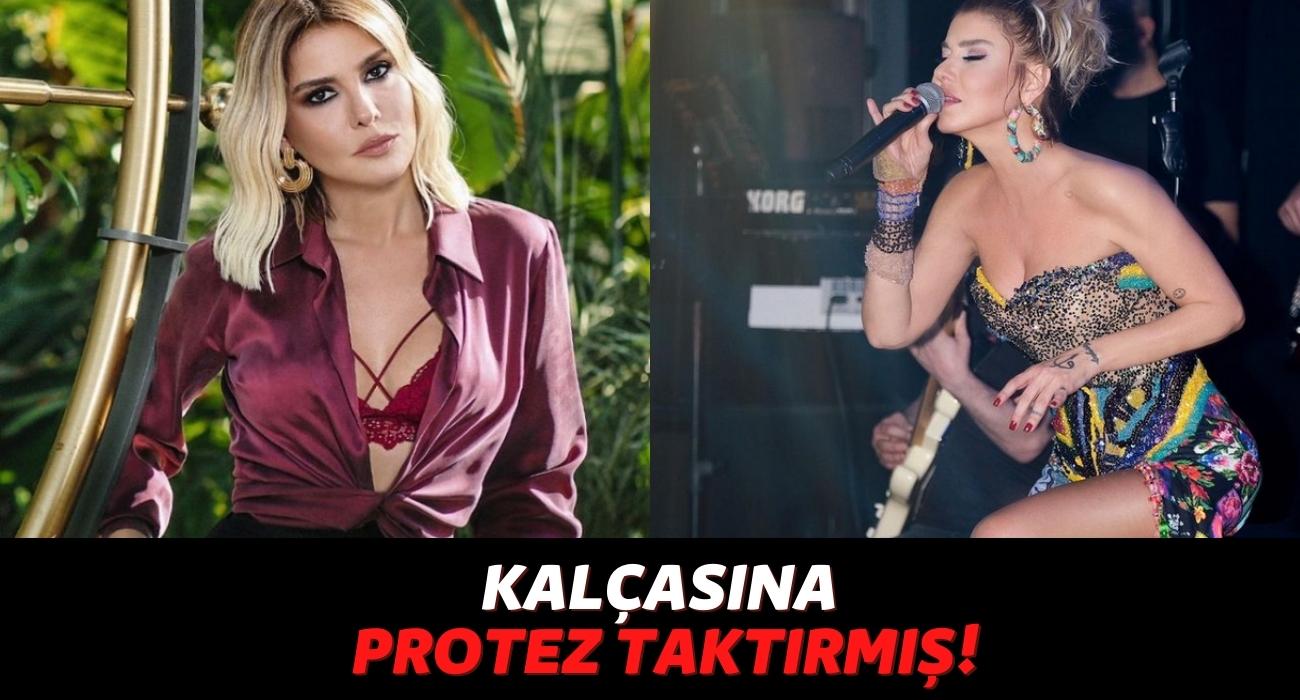 Gülben Ergen de Estetikliler Kervanına Katıldı, Belini İnceltmiş Kalçasına Protez Taktırmış!